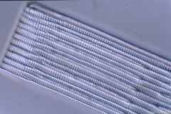 Rhabdonema