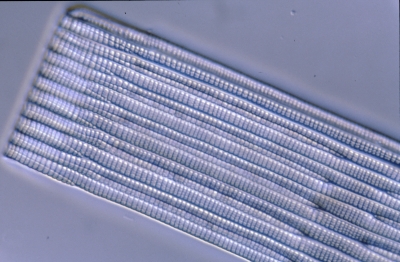 Rhabdonema adriaticum