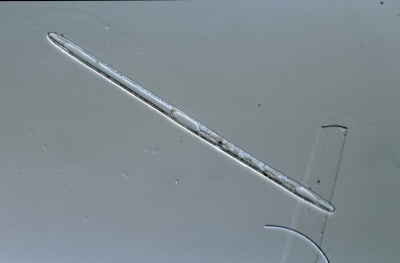Rhabdonema spec.