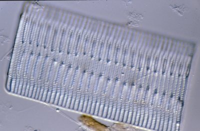 Rhabdonema adriaticum