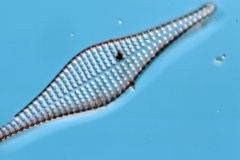 Rhaphoneis