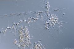 Rhizosolenia