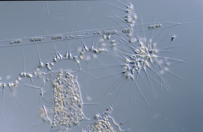 Rhizosolenia setigera