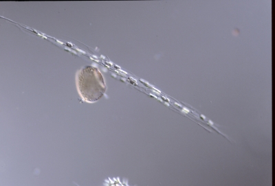 Rhizosolenia longiseta