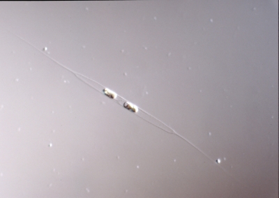 Rhizosolenia longiseta