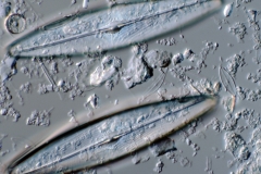 Scoliopleura