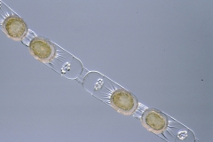 Stephanopyxis