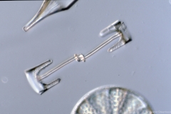 Syndetoneis