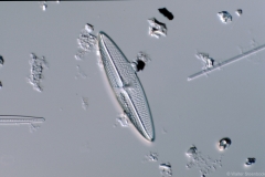 Trachyneis